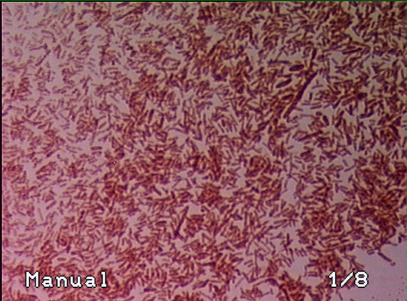 File:Gram-stain EYFP Ecoli.BMP