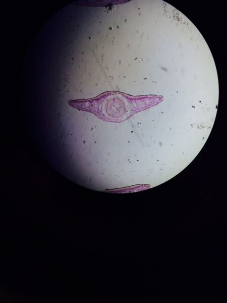 File:MG Lab 5 planaria cross section.jpg