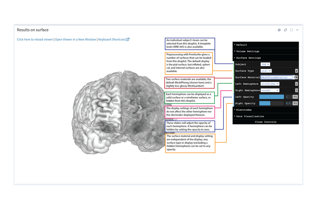 3D Viewer Surface Settings