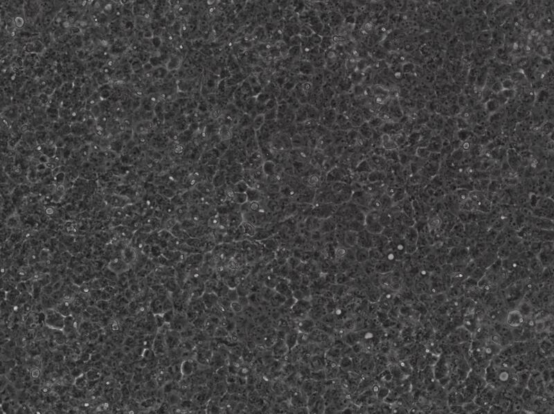 File:2015-05-11 Well 3 KAH87-MV10 phase mCherry10x.jpg