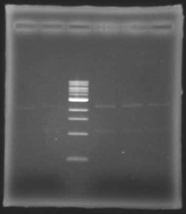 File:Extractionbefore RFP 090710.jpg