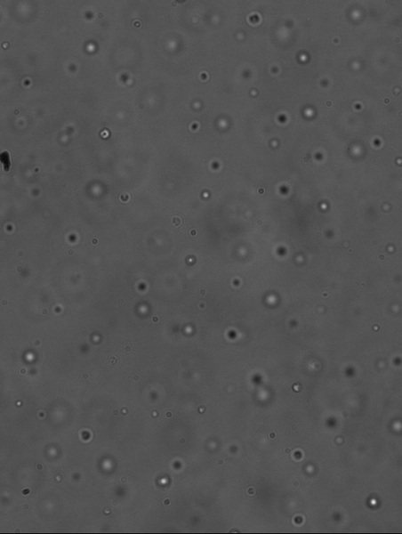 File:Microscope ferritin after mag.png