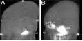Thumbnail for version as of 22:36, 3 December 2006